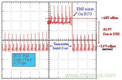 圖 1：醫(yī)用 ECG 測量設(shè)備的性能