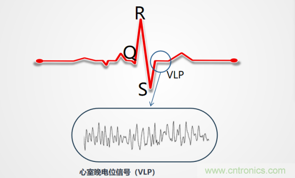 解決心電監(jiān)測行業(yè)難題，曼森伯格的濾波技術(shù)獲國家知識產(chǎn)權(quán)局發(fā)明授權(quán)